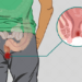 Anal Fissures: Diagnosis & Treatment